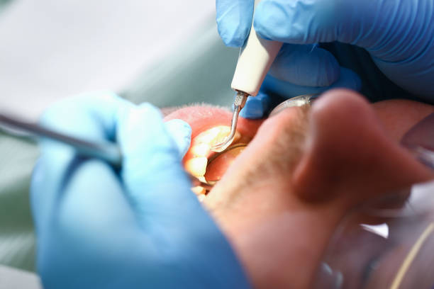 Best Emergency Dentist for Knocked-Out Tooth in Sughter, LA