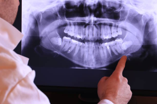 Best Emergency Root Canal Treatment in Sughter, LA