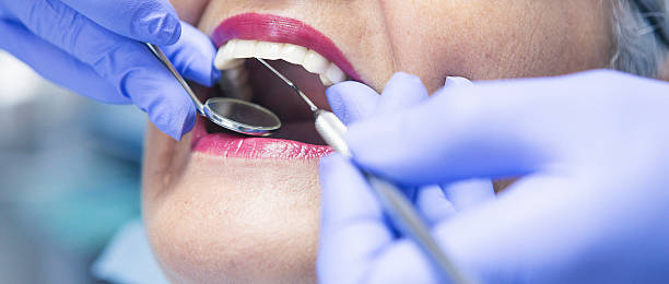 Best Emergency Dental Care for Abscessed Tooth in Sughter, LA